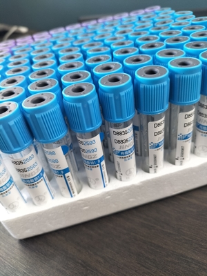 Medyczny specjalistyczny PET szkło testowe cytryny sodu 3,2% PT rurki 2-10 ml próżniowej rurki krwi